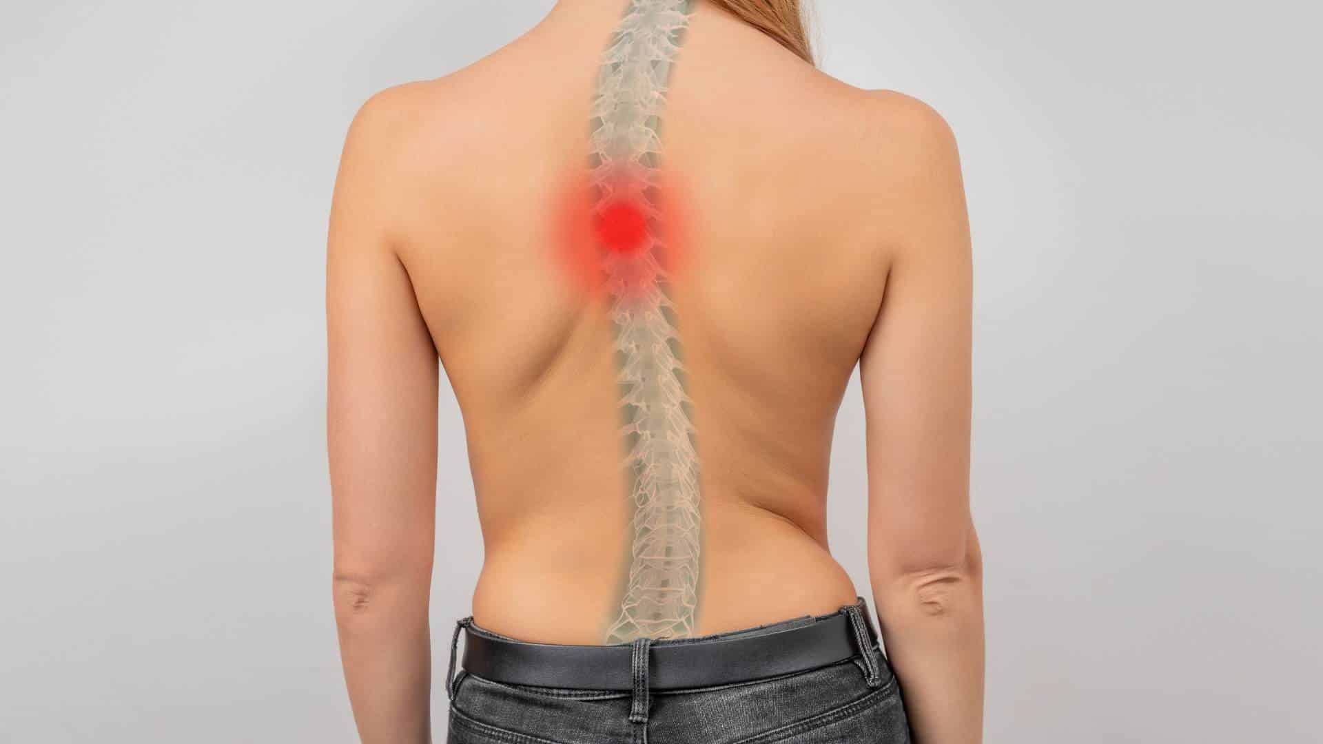 עקמת בגב - סקוליוזיס